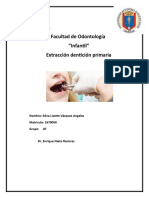 Extraccion denticion primaria (INFANTIL)