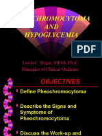 Pheochomocytoma and Hypoglycemia - Web