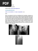 Caso Clinico 1 Osteomuscular 2021