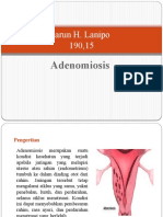 Adenomiosis