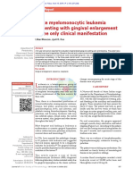 Acute Myelomonocytic Leukemia Presenting With Gingival Enlargement As The Only Clinical Manifestation