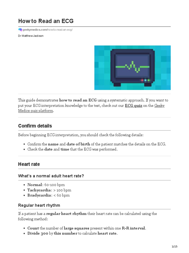How To Read An ECG | PDF | Electrocardiography | Heart Rate