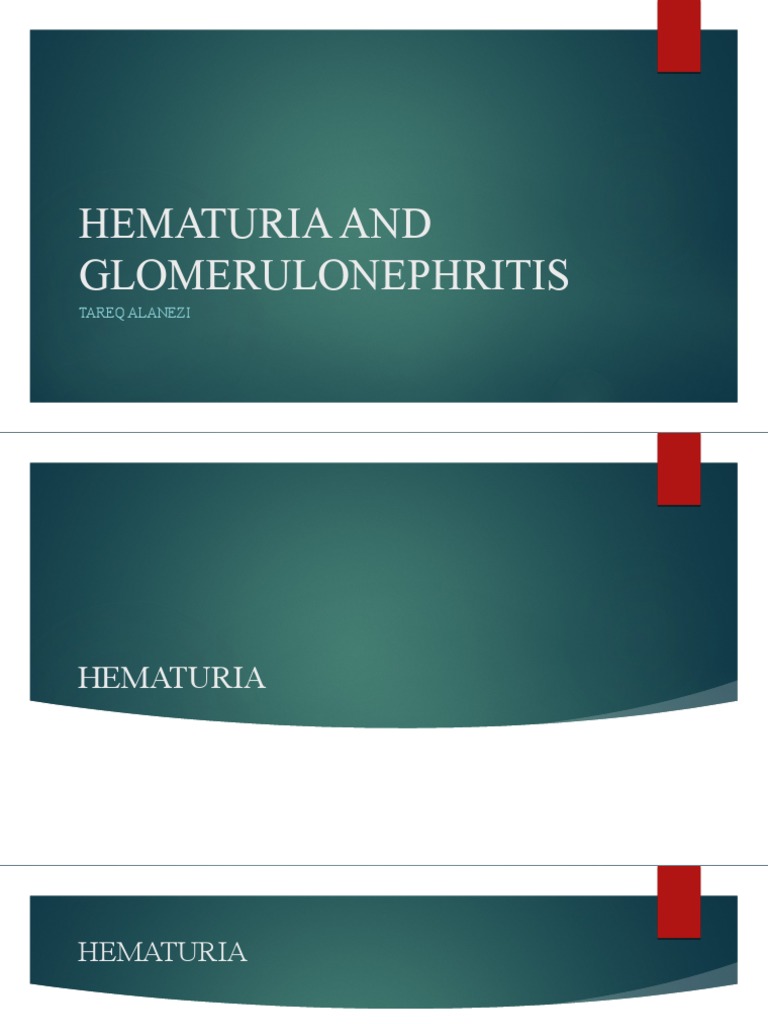 Hematuria and Glomerulonephritis A Focus on Poststreptococcal Acute Glomerulonephritis PDF