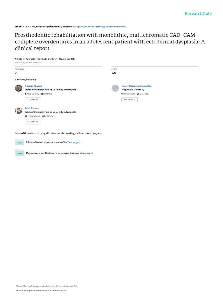 Prosthodontic Rehabilitation With Monolithic Multichromatic CAD-CAM ...