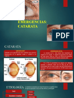 Emergencia Catarata