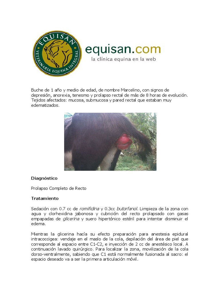 Prolapso rectal en buche: caso clínico | PDF | Recto | Cirugía