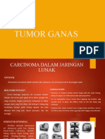 Tumor Ganas
