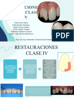 Restauraciones Clase IV y V-Grupo 2