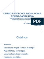 Neurorradiología 2