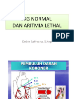 DR 6 EKG Normal & Aritmia Lethal