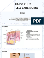 Onko - Khaziatun Nur - Tumor Kulit Basal Cell Ca