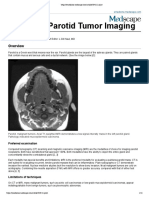 Malignant Parotid Tumor Imaging