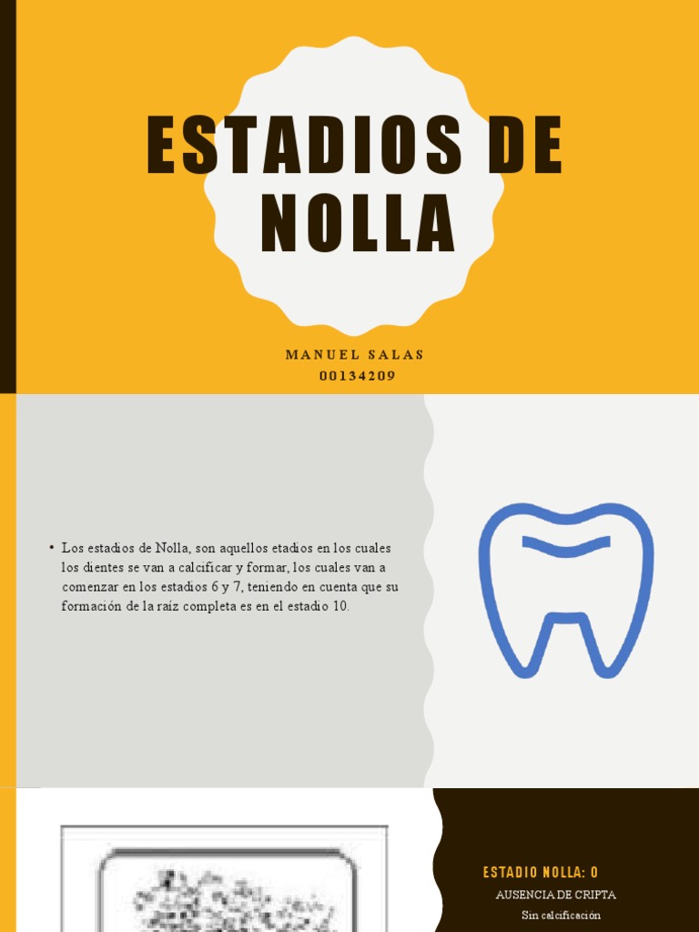 Estadios De Nolla 736x736