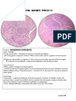 ACUTE PYELONEPHRITIS WITH ABSCESS: KIDNEY INFECTION