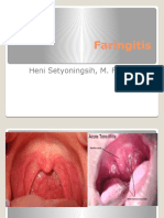 Faringitis