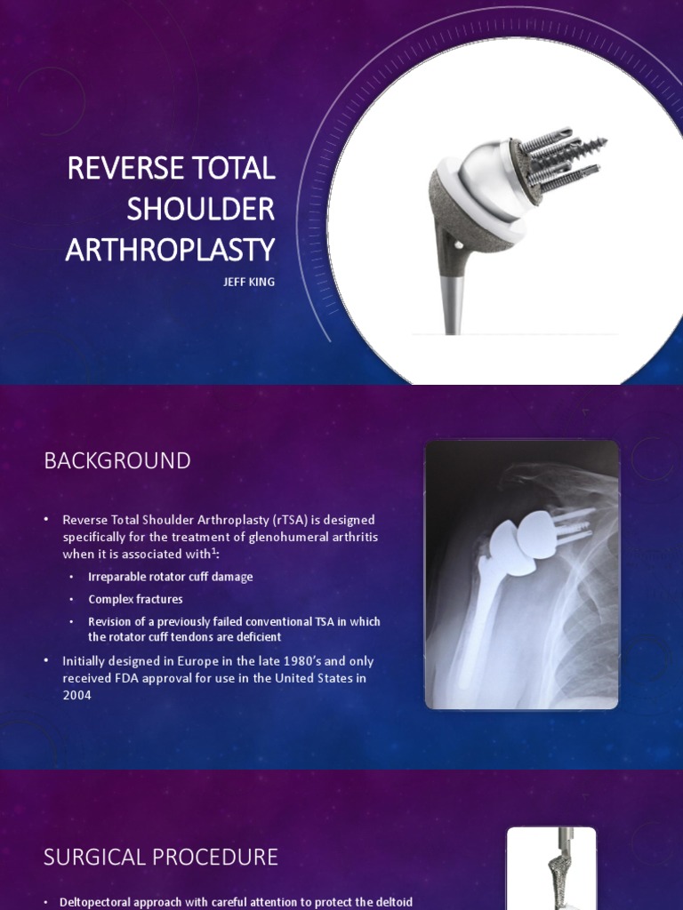 Reverse Total Shoulder Arthroplasty Guide | PDF | Shoulder | Anatomical ...