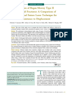 Fixation of Regan-Morrey Type II Coronoid Fractures: A Comparison of Screws and Suture Lasso Technique For Resistance To Displacement