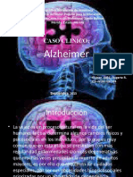 Alzheimer