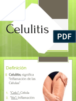 Celulitis