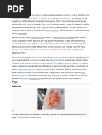 Download abortion by edenpearlcastillo SN50568339 doc pdf