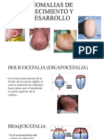 Anomalias de Crecimiento y Desarrollo Karoll