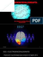 Electroencefalograma Itpp III