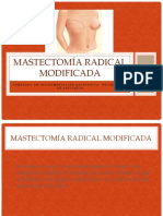 Mastectomía Radical Modificada