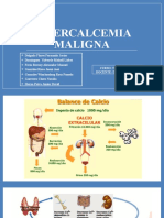 Hipercalcemia Maligna