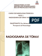 radiografia normal do torax
