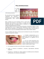 Placa bacteriana: causante de caries y enfermedad periodontal