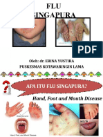 Penyuluja Flu Singapura