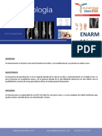 OSTEOSARCOMA