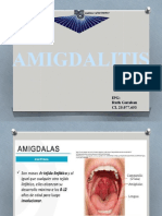 AMIGDALITIS