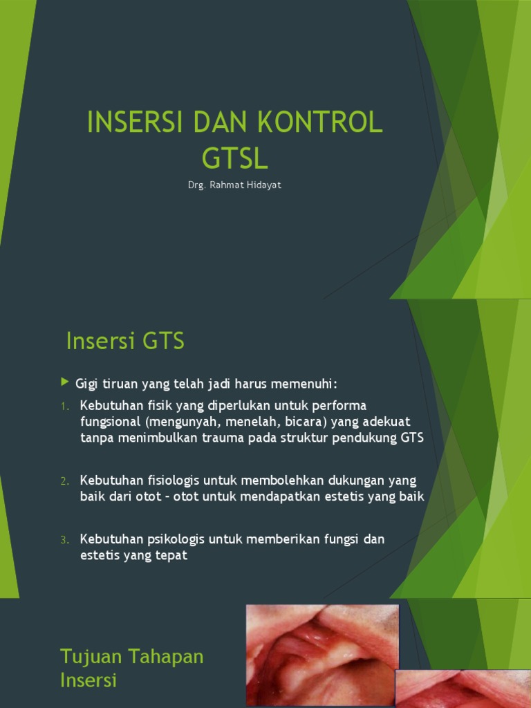 Prosedur Insersi Gigi Tiruan GTS | PDF