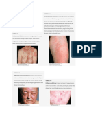 skin autoimmune -WPS Office