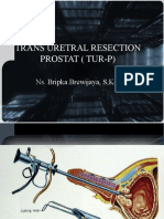 TRANS URETRAL RESECTION PROSTAT ( TUR-P)