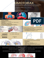 Infografia