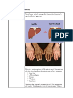 Assessment: Hemochromatosis (Iron Overload)