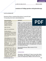 Case Study of Repigmentation of Vitiligo Patches With Phototherapy at Clinical Lab