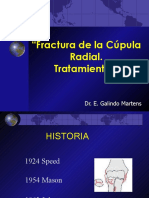 FX Cupula Radial 100814102759 Phpapp01