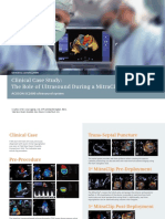 Siemens Acuson Sc2000 Clinical Case Study Mitraclip