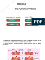 Hemofilia Sintomatologia Del Paciente