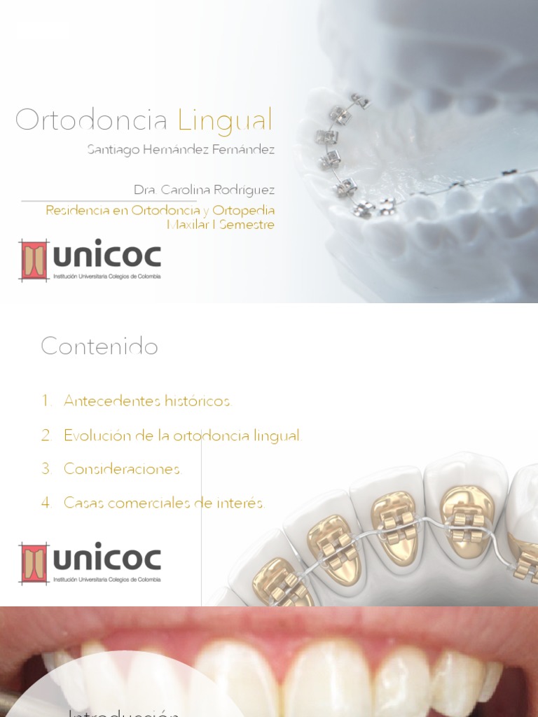 Ortodoncia Lingual | PDF | Ortodoncia | Cara