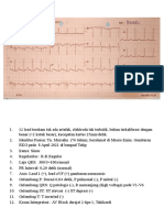 Interpretasi EKG Rika