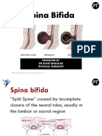 Spina Bifida - DR Rohit Bhaskar