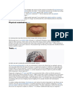 Physical Examination: An Individual Who Has Bitten The Tip of Their Tongue While Having A Seizure
