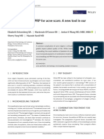 Microneedling and PRP For Acne Scars: A New Tool in Our Arsenal