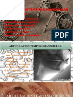 ATM: Articulación temporomandibular