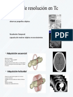 Tipos de Resolución en TC