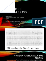  Sinus Node Blocks Diagnostic